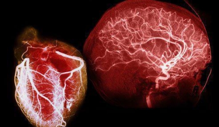 Creierul NU este singurul organ care are NEURONI